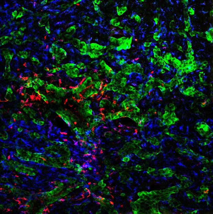 CD74⁺ microglia/macrophages surrounding and infiltrating experimental brain metastasis