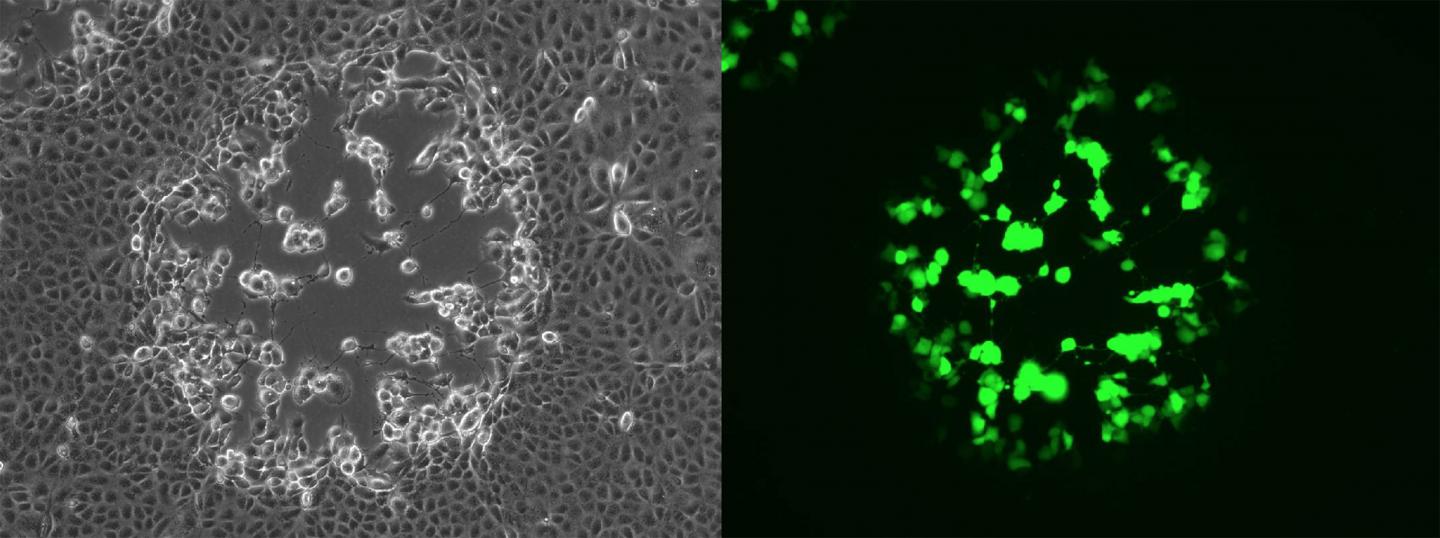 Vaccinia Virus-Infected African Green Monkey Cells