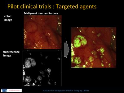 Ovarian Tumor Cells