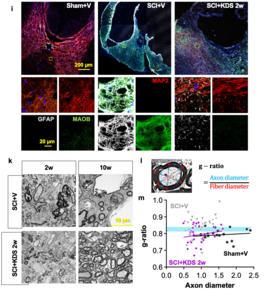 Figure 2. Neuroprotective and tissue-restorative effects of KDS2010