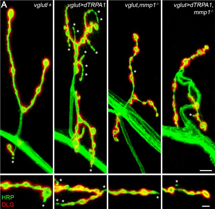 Special Issue: New Frontiers in Fragile X Syndrome: The Most Common Heritable Intellectual Disability (1 of 5)