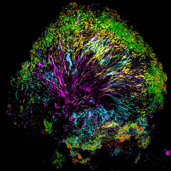 A microscopic image of bacteria in dental plaque.