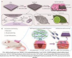 Antibacterial and biodegradable bandage with exudate absorption and smart monitoring for chronic wound management