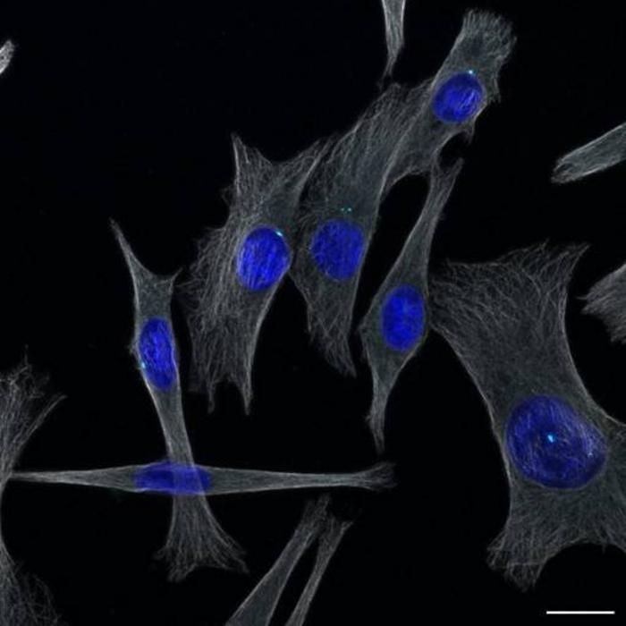 Melanoma cells