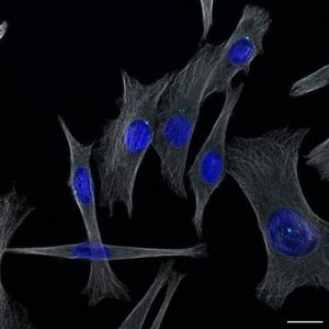 Melanoma cells