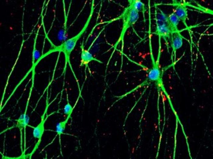 The fluorescence image of iPSC-converted neuron in a culture dish.