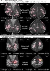 Screening Mammograms