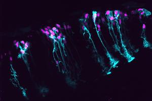 Astrocytes