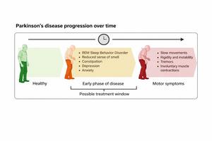 Disease progression over time for Parkinson's