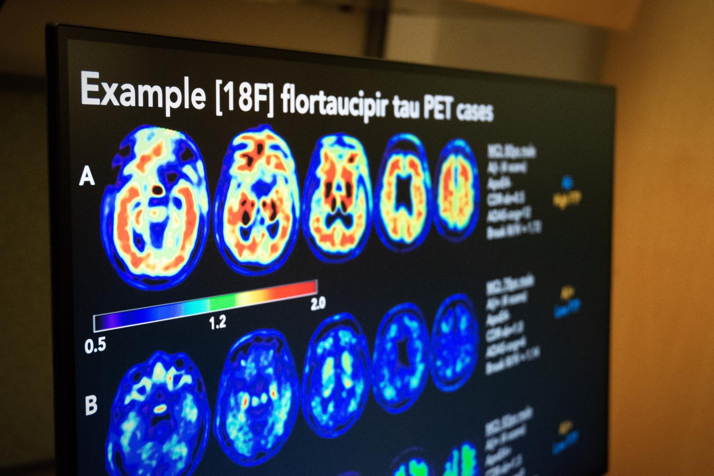 Brain Imaging