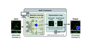 AI Computation Enables Clearer Views of the Deep Brain, Bypassing the Need for Expensive Equipment​