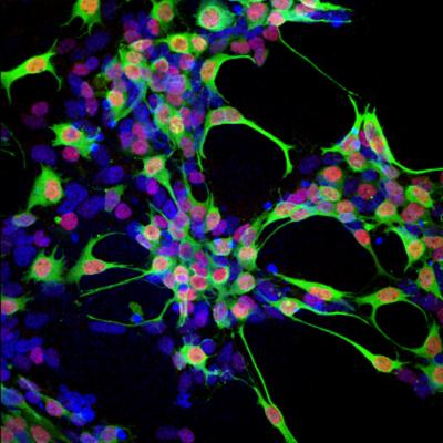 Photoreceptor Cells