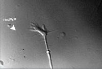 Hippocampal Growth Cone