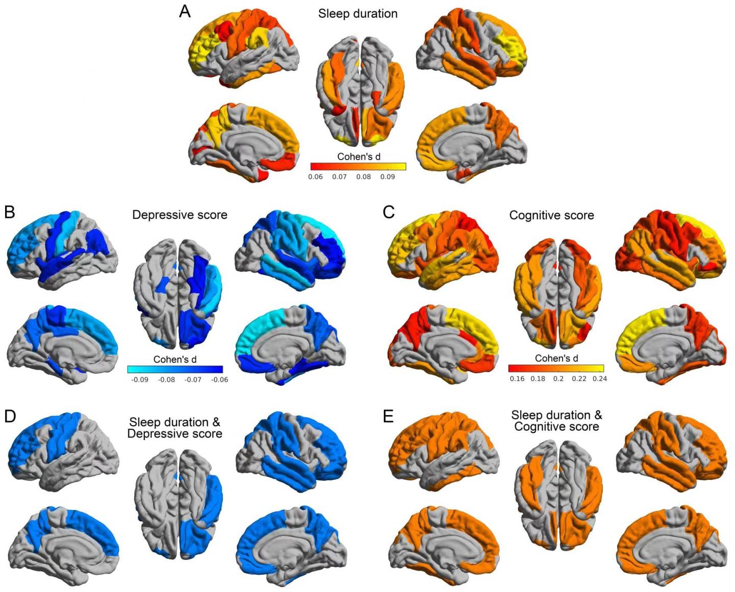 Different Parts of the Brain Effected by Sleep