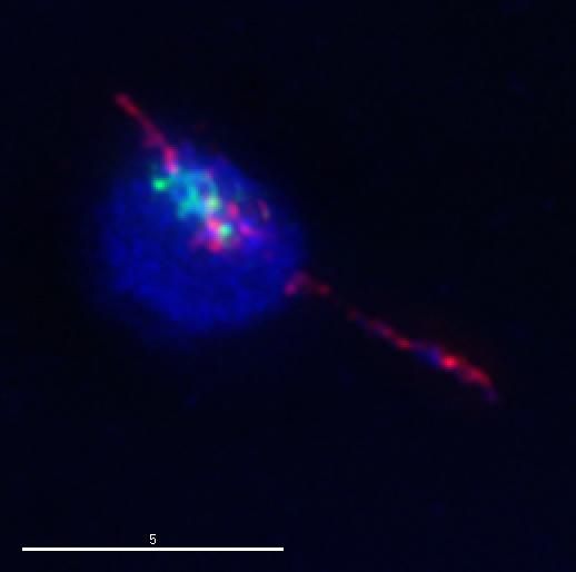 Oocyte with Decreased Topoiosmerase II