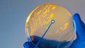 Attack and defence in the microverse | EurekAlert!