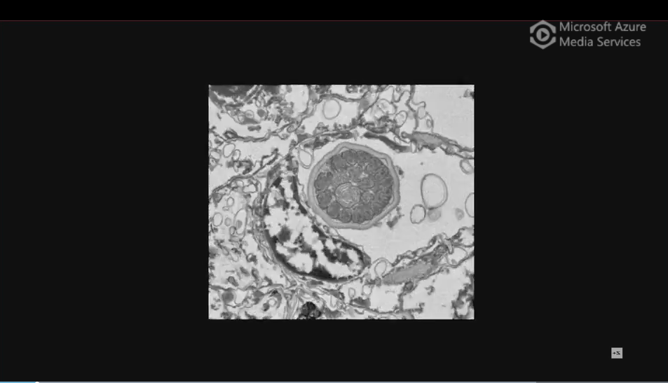3D reconstruction of the sea anemone's stinging organelle