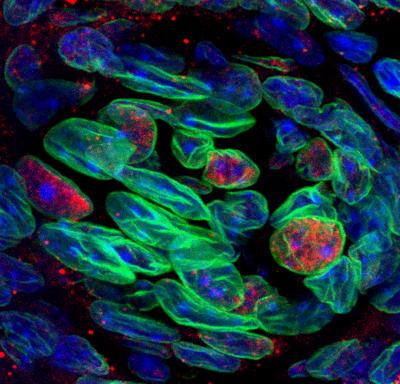 Sugar Sensor in Taste Cells