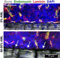 Blood Vessel Loss