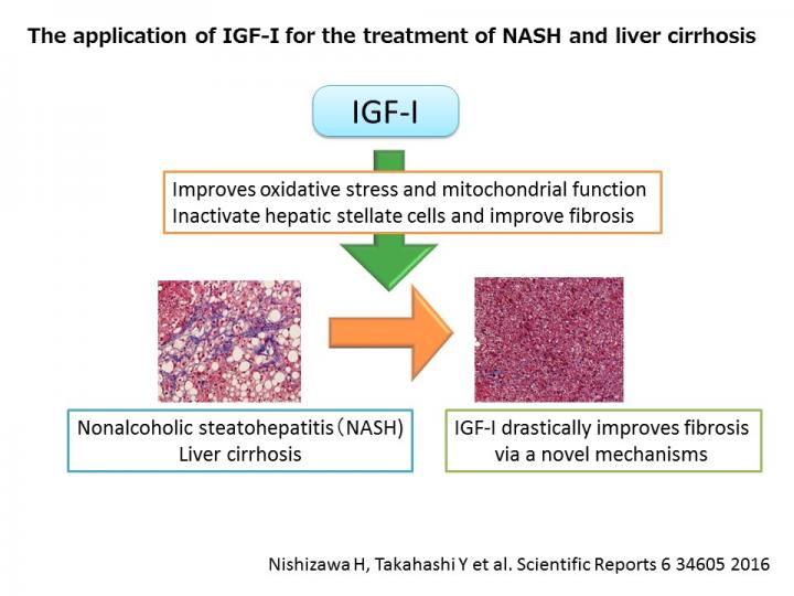IGF-I