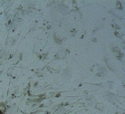 Lab-Made Skin Cells