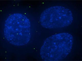 Viral Extinction