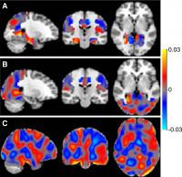 Brain Scans