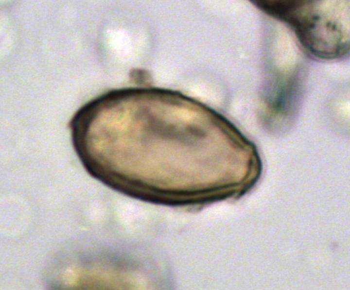 Egg of Chinese Liver Fluke