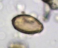Egg of Chinese Liver Fluke