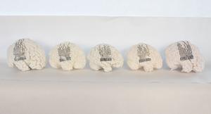 3D Printed Brain Models