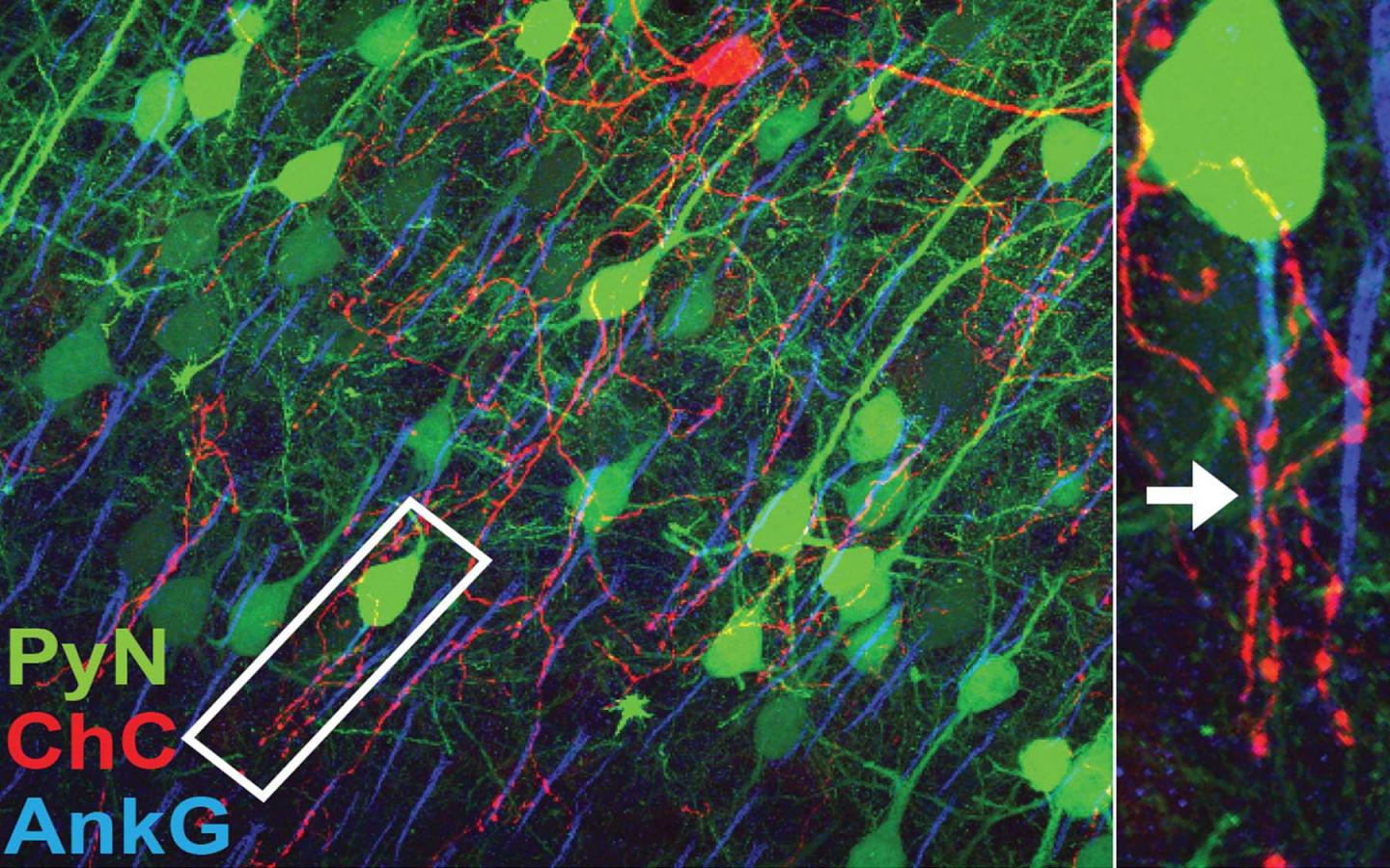 Chandelier Cell Fibers