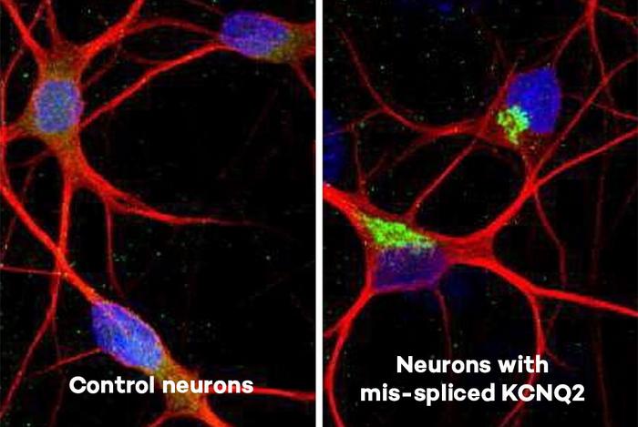Neuron comparison