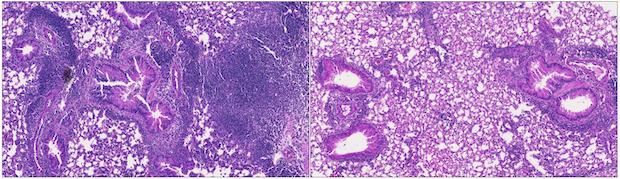 LJI study suggests future asthma therapies need to target two key immune molecules