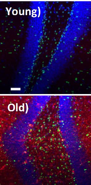 TGF-beta1 in Old and New Hippocampus