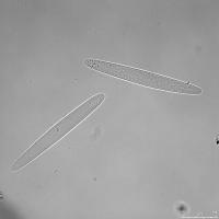 Giant Bacteria Make Algae Easy to Stomach (1 of 3)