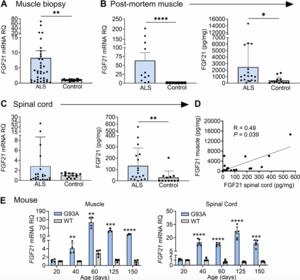 The myokine FGF21 associates with enhanced survival in ALS and mitigates stress-induced cytotoxicity