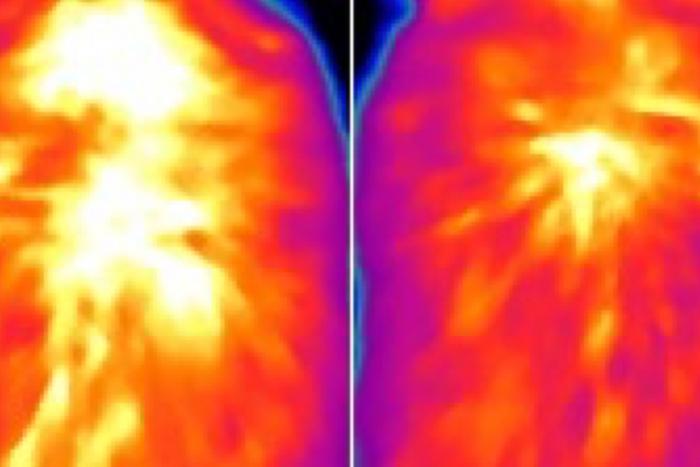 Novel way to ‘rev up’ brown fat burns calories, limits obesity in mice