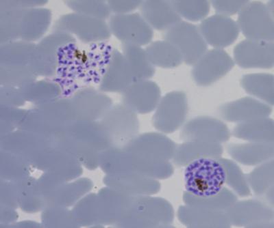 Infected Red Blood Cells