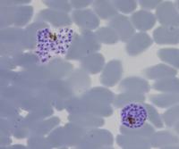 Infected Red Blood Cells