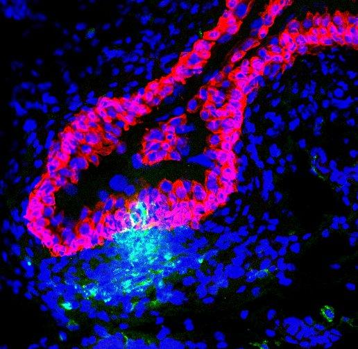 Duke scientists develop vaccine strategy for urinary tract infections
