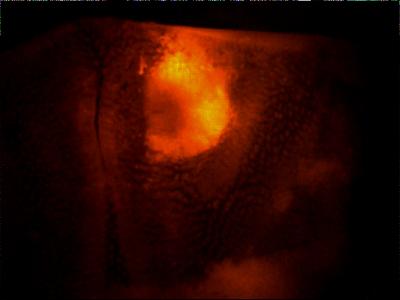 In vivo Labeling of COX-2 Expression in Intestinal Polyp
