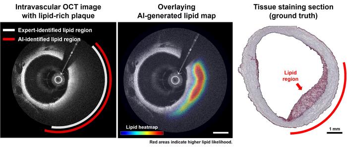 AI and histology comparison