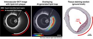 AI and histology comparison