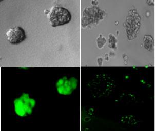 Bacteria Molecule Kills Cancer Cells