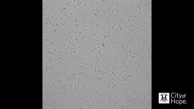 T Cells Eradicating Tumor Cells