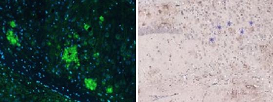 Antibodies