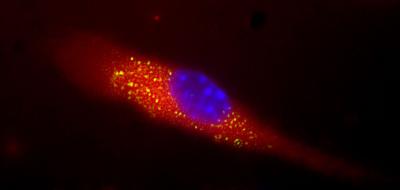 Visualizing the 'Nanosponge Vaccine' from UC San Diego