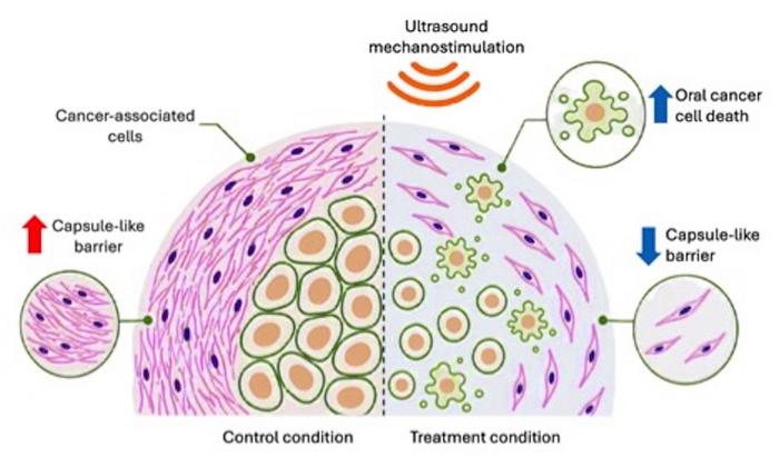 Ultrasound mechanostimulation-mediated killing of oral cancer cells and compromised integrity of the capsule-like barrier