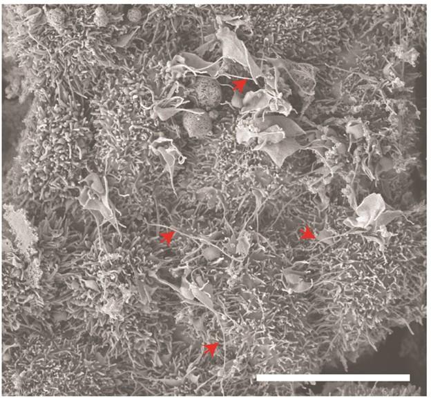 Electron Microscopy Image