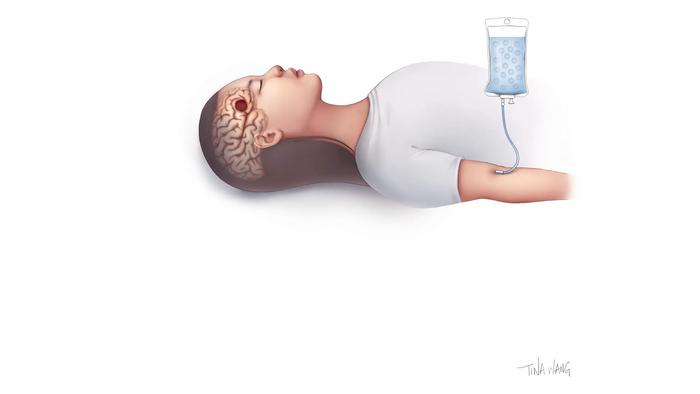 Visualization of FUS